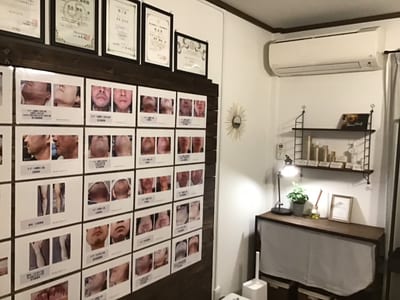脱毛サロン Men's YUSYURE 店内写真 4枚目