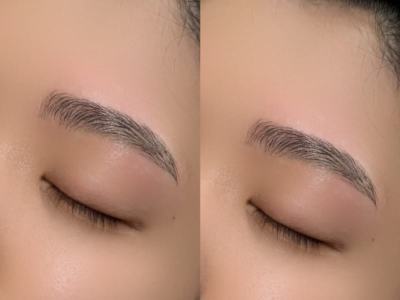 Liley eye.(倉敷市)