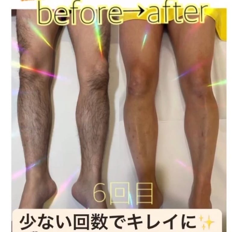 TotalBeautySalon MiMiy MORIOKA（盛岡）のメンズ眉毛サロン