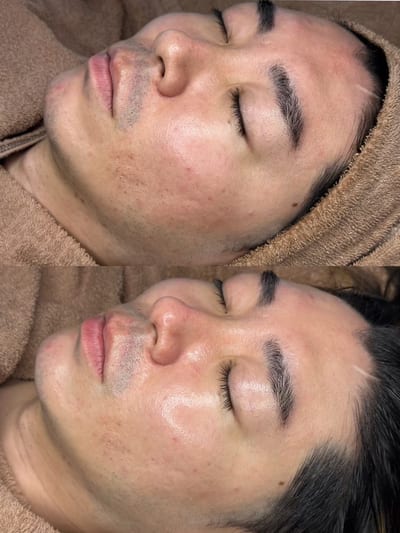 医療提携サロンLino沼津 シミケア・脱毛・眉毛 店内写真 4枚目