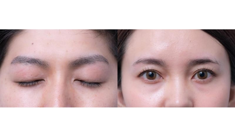 一度脱毛した眉毛はケア要らず次世代アイブロウ・眉毛脱毛研究所 MDラボ大垣店（大垣市）
