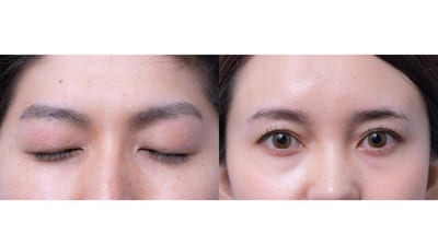一度脱毛した眉毛はケア要らず次世代アイブロウ・眉毛脱毛研究所 MDラボ大垣店 店内写真 1枚目